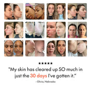 Filterbaby Skincare Filter 2.0