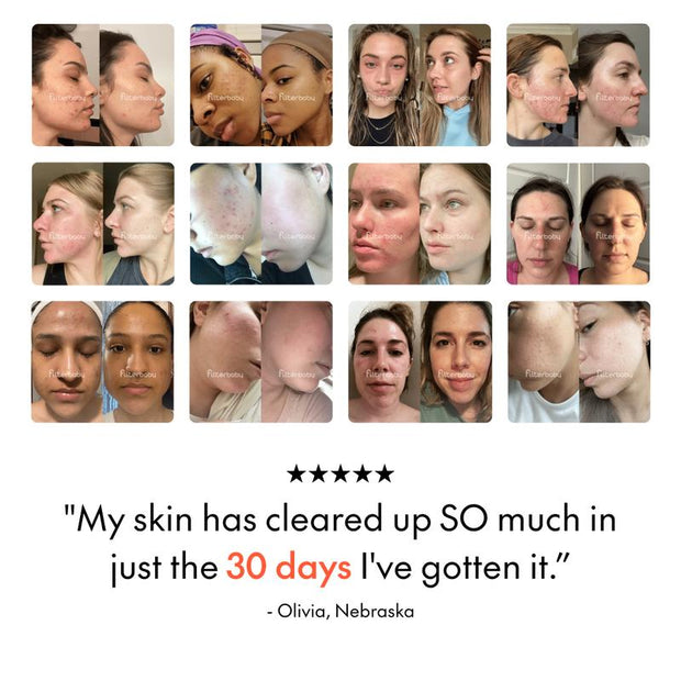 Filterbaby Skincare Filter 2.0